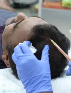 Platelet Rich Plasma