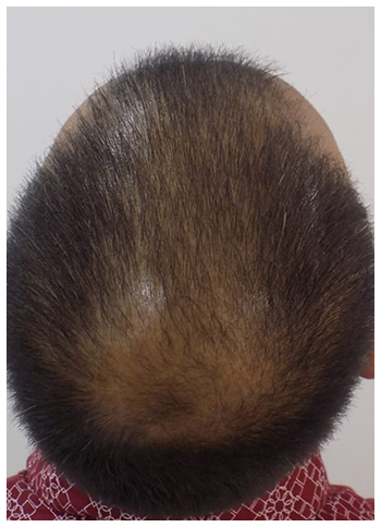 Hair-Threads-before-1.png Hair-Threads-before-1.png