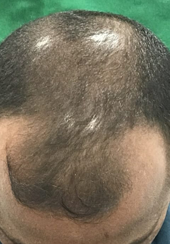 dfdfd1.png dfdfd1.png