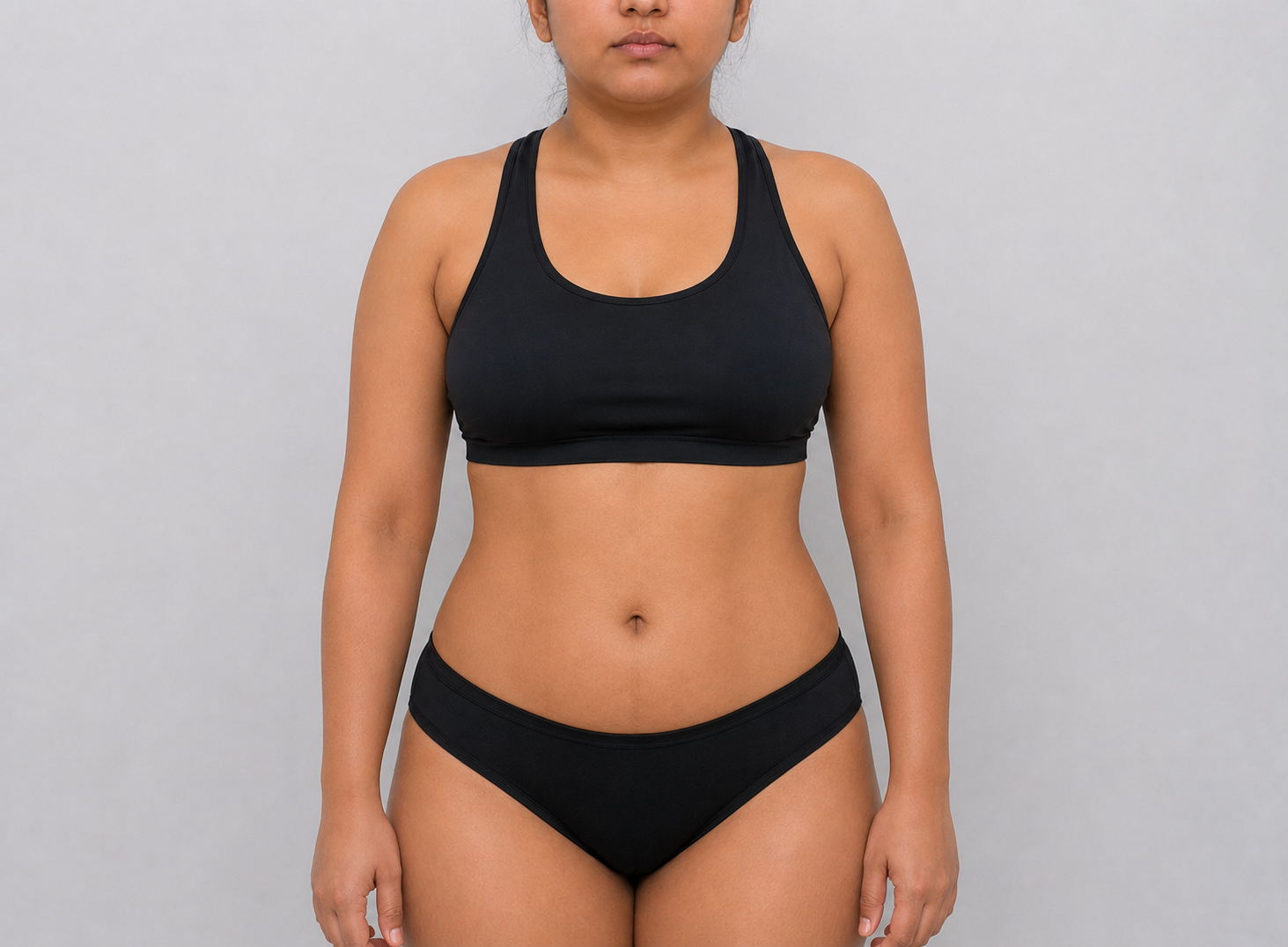 Body Contouring after result