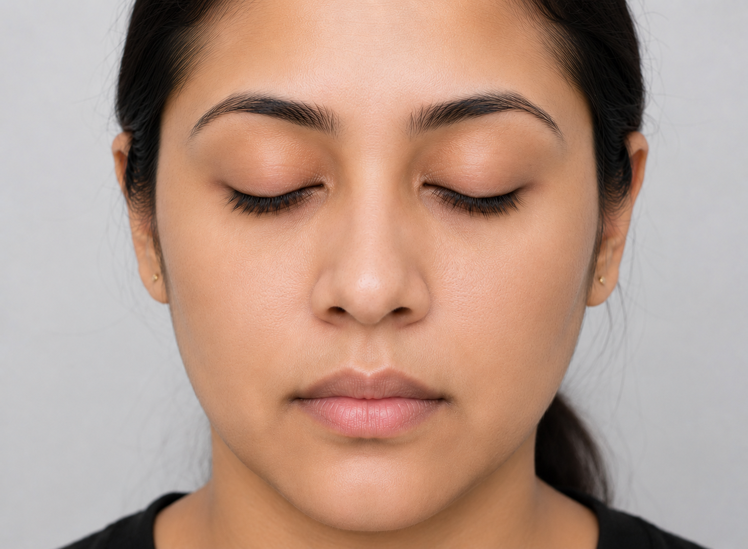 Skin Whitening Treatment after result