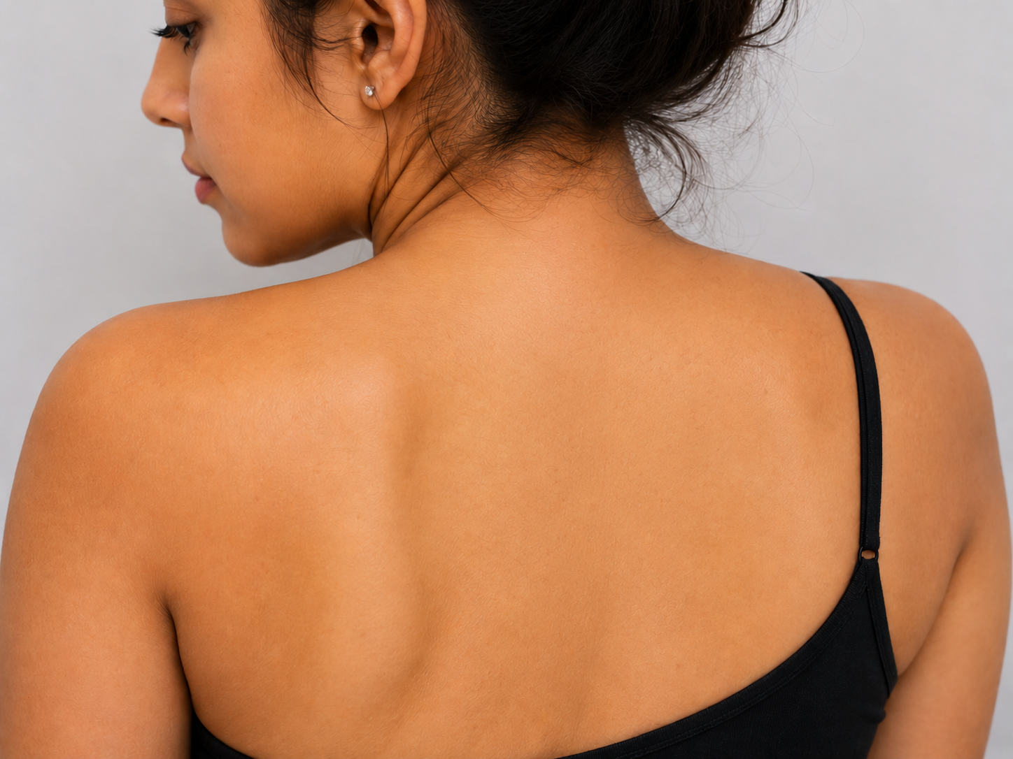 Tattoo Removal after result
