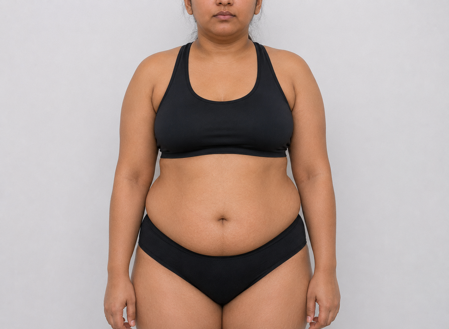 Body Contouring before result