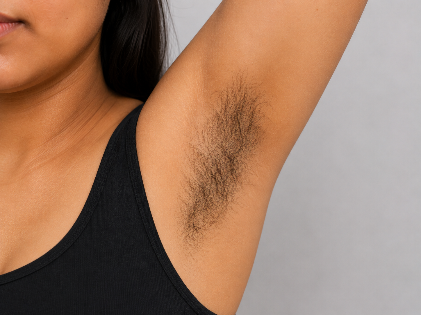 Full Body Laser Hair Removal before result